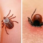 Da biste uklonili KRPELJA potrebna vam je SAMO JEDNA NAMIRNICA… Da biste uklonili KRPELJA potrebna vam je SAMO JEDNA NAMIRNICA…