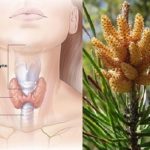 RECEPT ruske narodne medicine: Izliječite štitnu žlijezdu RECEPT ruske narodne medicine: Izliječite štitnu žlijezdu