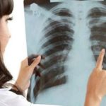 Ovaj vitamin liječi upalu pluća za samo 3 sata…. Ovaj vitamin liječi upalu pluća za samo 3 sata….
