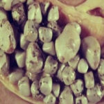 Otklonite žučne kamenace prirodnim putem! Otklonite žučne kamenace prirodnim putem!