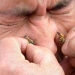 Nećete vjerovati šta se sve liječi pčelinjim ubodom Nećete vjerovati šta se sve liječi pčelinjim ubodom