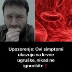 Znate Li Kako Prepoznati KRVNE UGRUŠKE? Ove Simptome Shvatite JAKO OZBILJNO ! Znate Li Kako Prepoznati KRVNE UGRUŠKE? Ove Simptome Shvatite JAKO OZBILJNO !