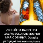 ZBOG ČEGA RAK PLUĆA IZAZIVA BOLU RAMENU? DR MARIĆ OTKRIVA: Obratite Pažnju Još I Na Ove Simptome ZBOG ČEGA RAK PLUĆA IZAZIVA BOLU RAMENU? DR MARIĆ OTKRIVA: Obratite Pažnju Još I Na Ove Simptome