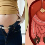 MNOGI GRIJEŠE MISLEĆI DA SU DEBELI, A ZAPRAVO SE O OVOME RADI: Evo zbog čega vam je stomak velik MNOGI GRIJEŠE MISLEĆI DA SU DEBELI, A ZAPRAVO SE O OVOME RADI: Evo zbog čega vam je stomak velik