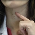 ŠTITNA ŽLIJEZDA SE PREPORODI ZA NEKOLIKO NEDJELJA: Dovedite hormone u red prirodnim sredstvima ŠTITNA ŽLIJEZDA SE PREPORODI ZA NEKOLIKO NEDJELJA: Dovedite hormone u red prirodnim sredstvima