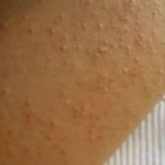7 znakova netolerancije na gluten, koje mnogi ignorišu! 7 znakova netolerancije na gluten, koje mnogi ignorišu!